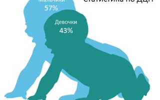 Новорожденные дети с синдромом дцп