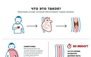 Окс без подъема код мкб