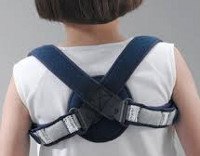 Перелом ключицы у детей
