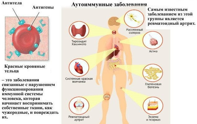Аутоиммунные заболевания