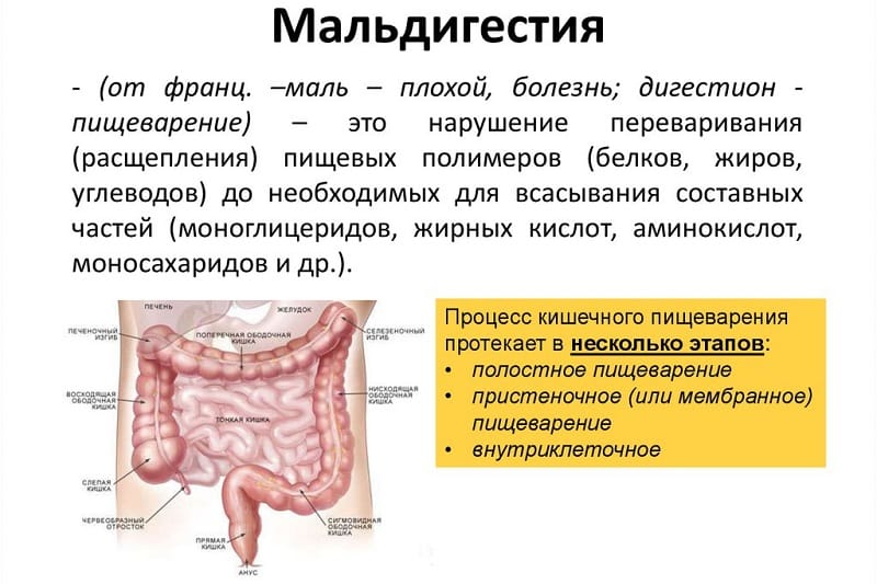 Что такое синдром мальабсорбции и мальдигестии: симптомы и лечение