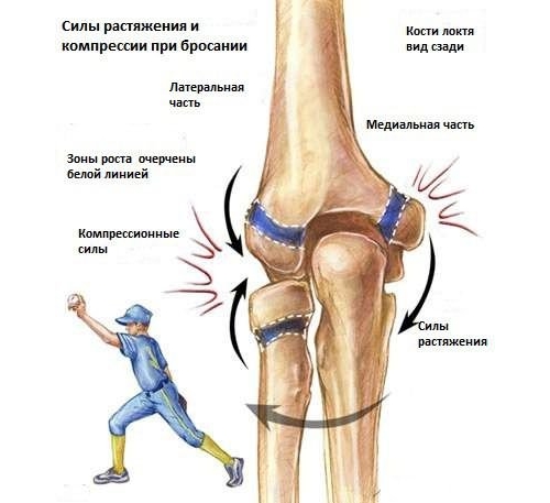 Противоборствующие силы, которые приводят к травме сустава