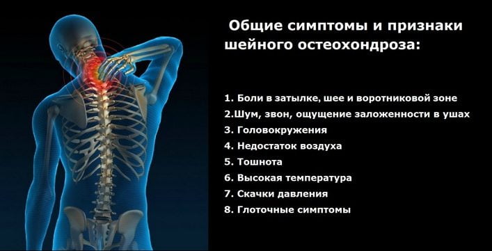 Остеохондроз поясничного отдела с корешковым синдромом симптомы лечение