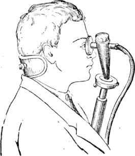 belmo-lechenie