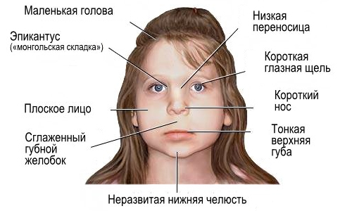 Симптомы и признаки заболевания
