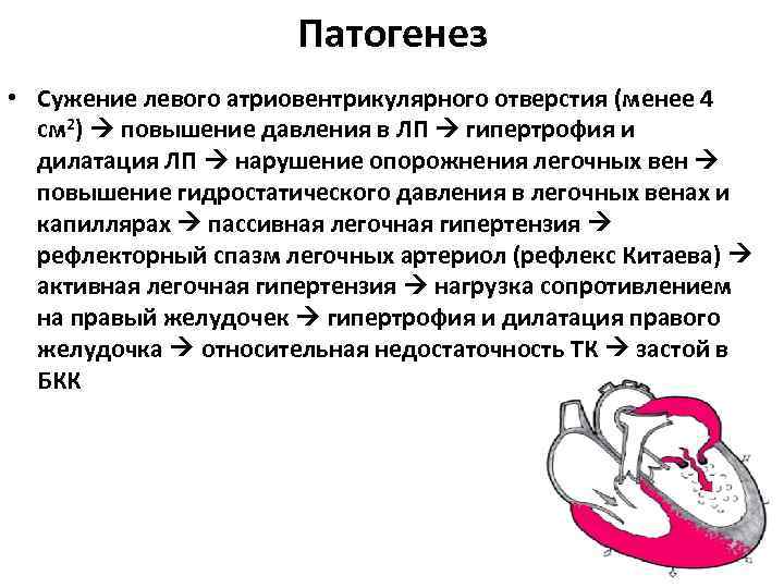 Патогенез • Сужение левого атриовентрикулярного отверстия (менее 4 см 2) повышение давления в ЛП Патогенез • Сужение левого атриовентрикулярного отверстия (менее 4 см 2) повышение давления в ЛП