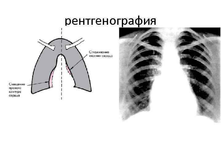 рентгенография рентгенография