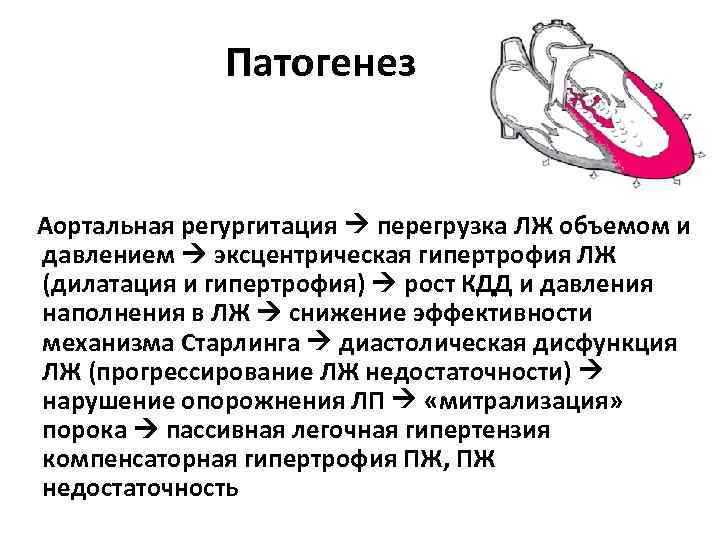 Патогенез Аортальная регургитация перегрузка ЛЖ объемом и давлением эксцентрическая гипертрофия ЛЖ (дилатация и гипертрофия) Патогенез Аортальная регургитация перегрузка ЛЖ объемом и давлением эксцентрическая гипертрофия ЛЖ (дилатация и гипертрофия)