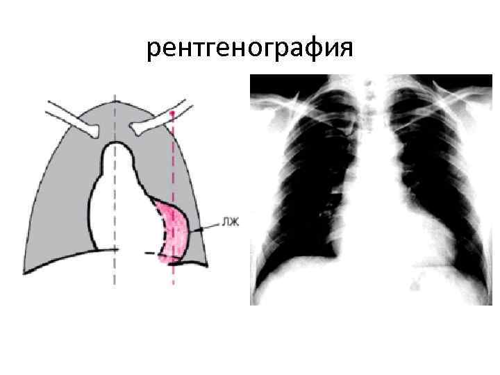 рентгенография рентгенография