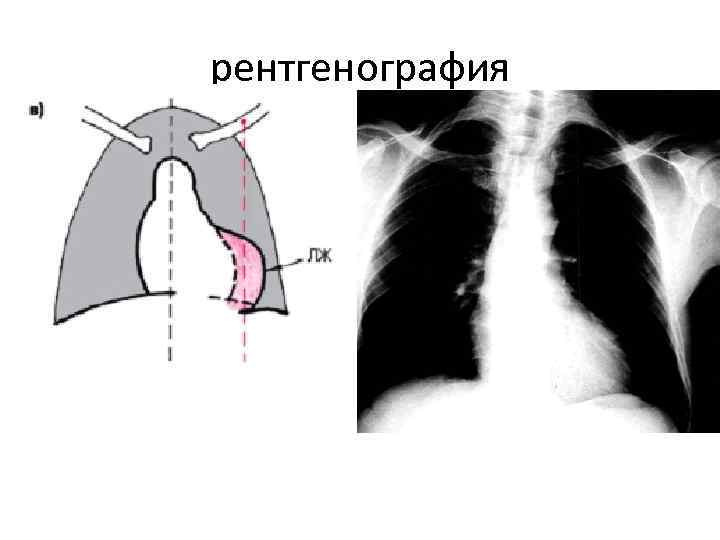 рентгенография рентгенография