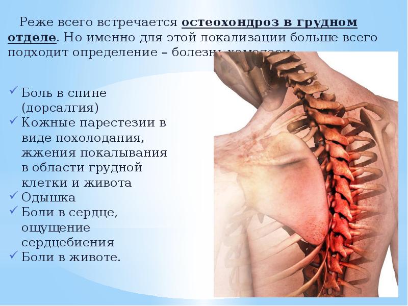 Остеохондроз поясничного отдела с корешковым синдромом симптомы лечение