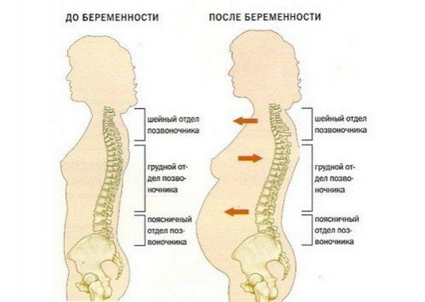 Влияние беременности на позвоночник