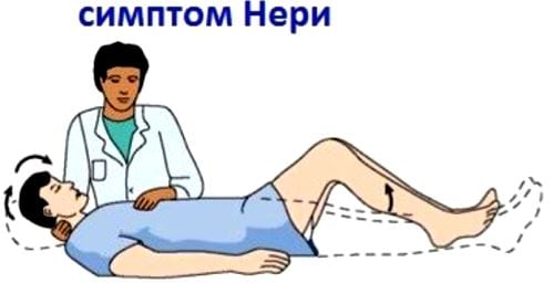 Остеохондроз поясничного отдела с корешковым синдромом симптомы лечение
