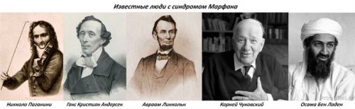 Известные люди с синдромом Марфана