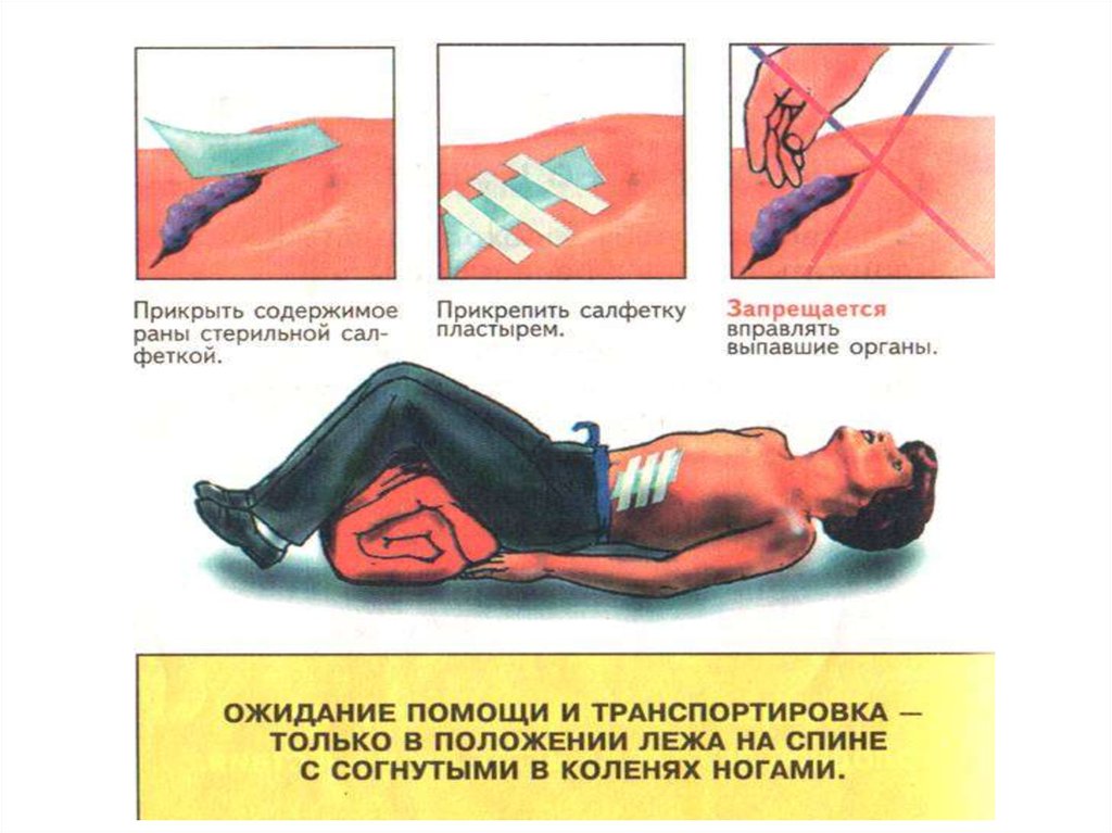 Колото резаное ранение брюшной полости код по мкб