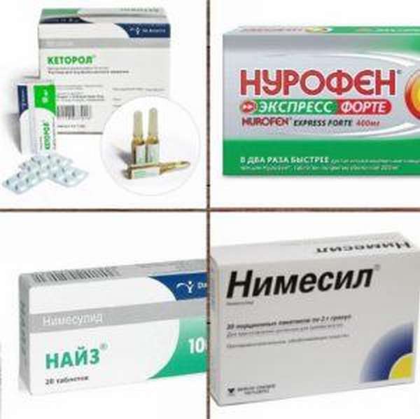 Воспаление сухожилия на руке синдром